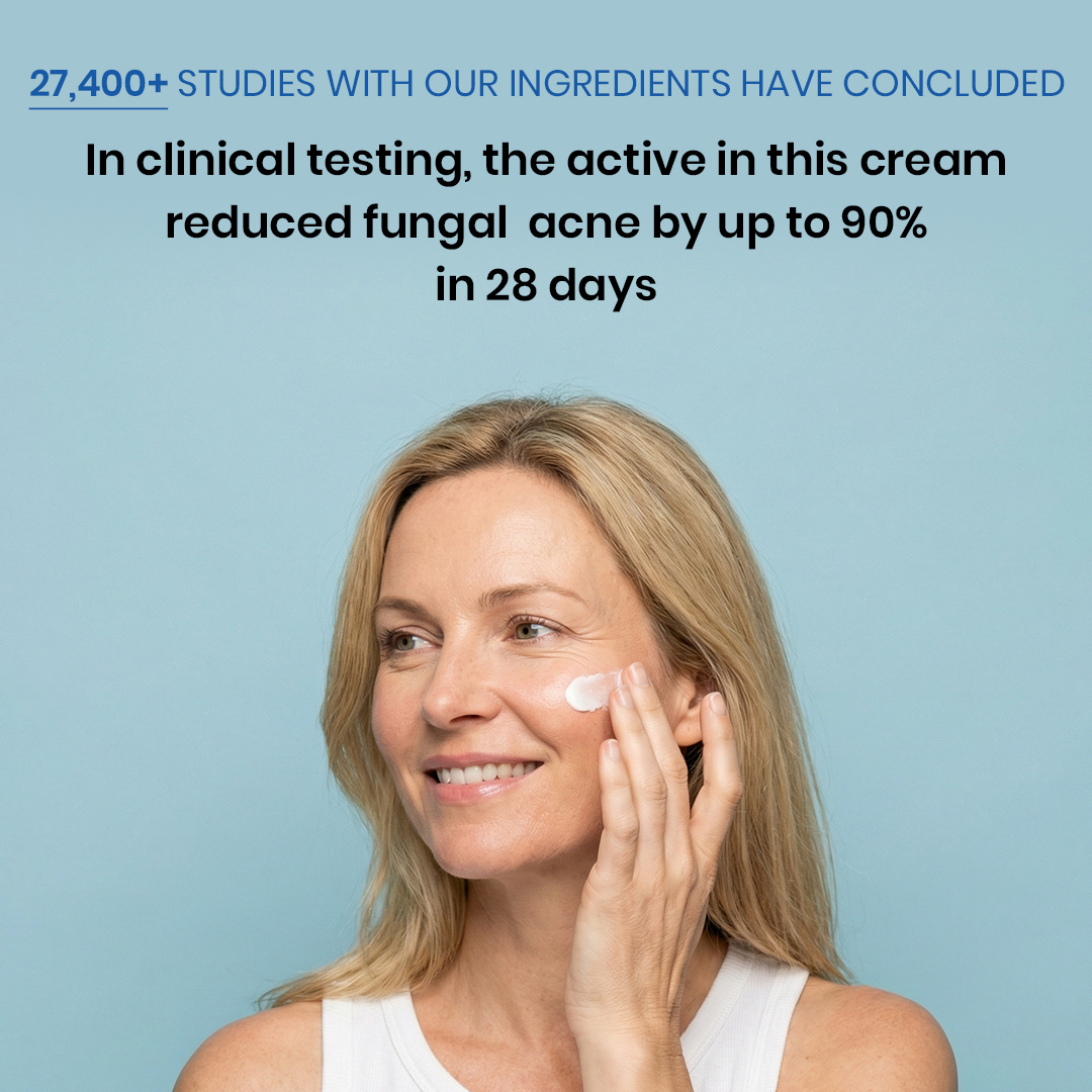 New Aura™ Anti-Fungal Acne Cream
